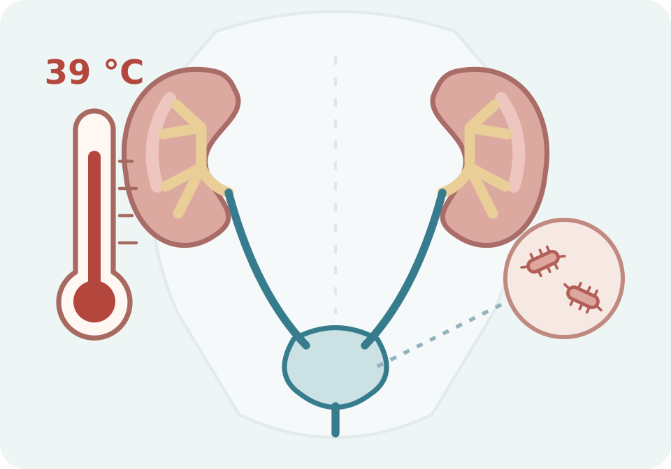 Via urinària amb una ampliació simbòlica de bacteris i un termòmetre de 39 °C que representa la possible febre associada a una infecció.